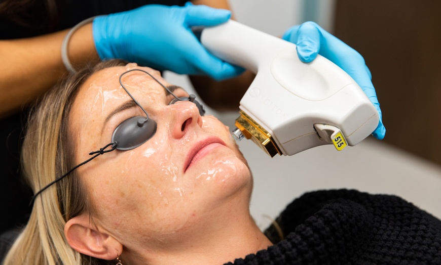 Image 1: Refresh w/ BBL IPL Photofacial Treatments for Face, Neck, & Décolleté