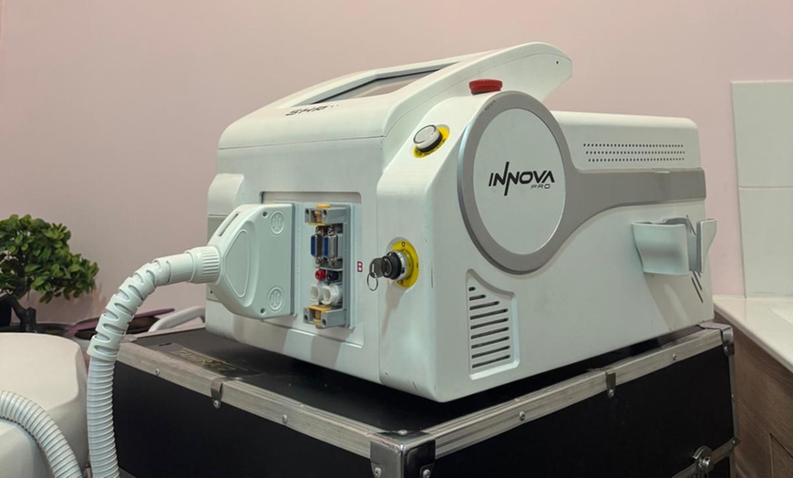 Image 5: Depilación con láser SHR en zona corporal a elegir: 3, 5 o 7 sesiones