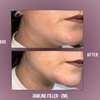 Image 4: Up to 71% Off on Injection - Dermal Filler at Divine Aesthetics Clinic London