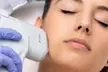 Sesión de HIFU 13D ultralifting con radiofrecuencia para 1 persona en zona facial o rostro completo, al 79% - Second Medium