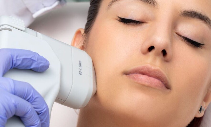 Image 6: HIFU 13D ultralifting facial con radiofrecuencia en zona a elegir