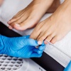 Image 3: Bis zu 55% Rabatt auf den Pediküre bei MRA-PODIATRY