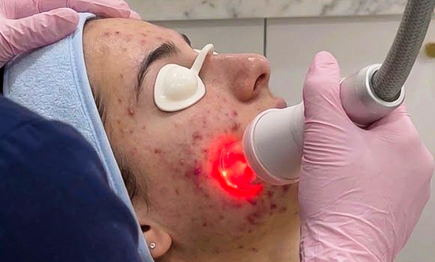 Image 4: Fractional Laser Skin Resurfacing for Face or Neck: 1 or 3 Treatments