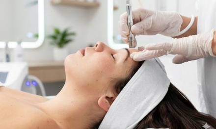 1 Sesión de peeling químico con ácido salicílico, acelaico y principio activo para tratamiento de acné - O & B Estetica avanzada y depilación láser