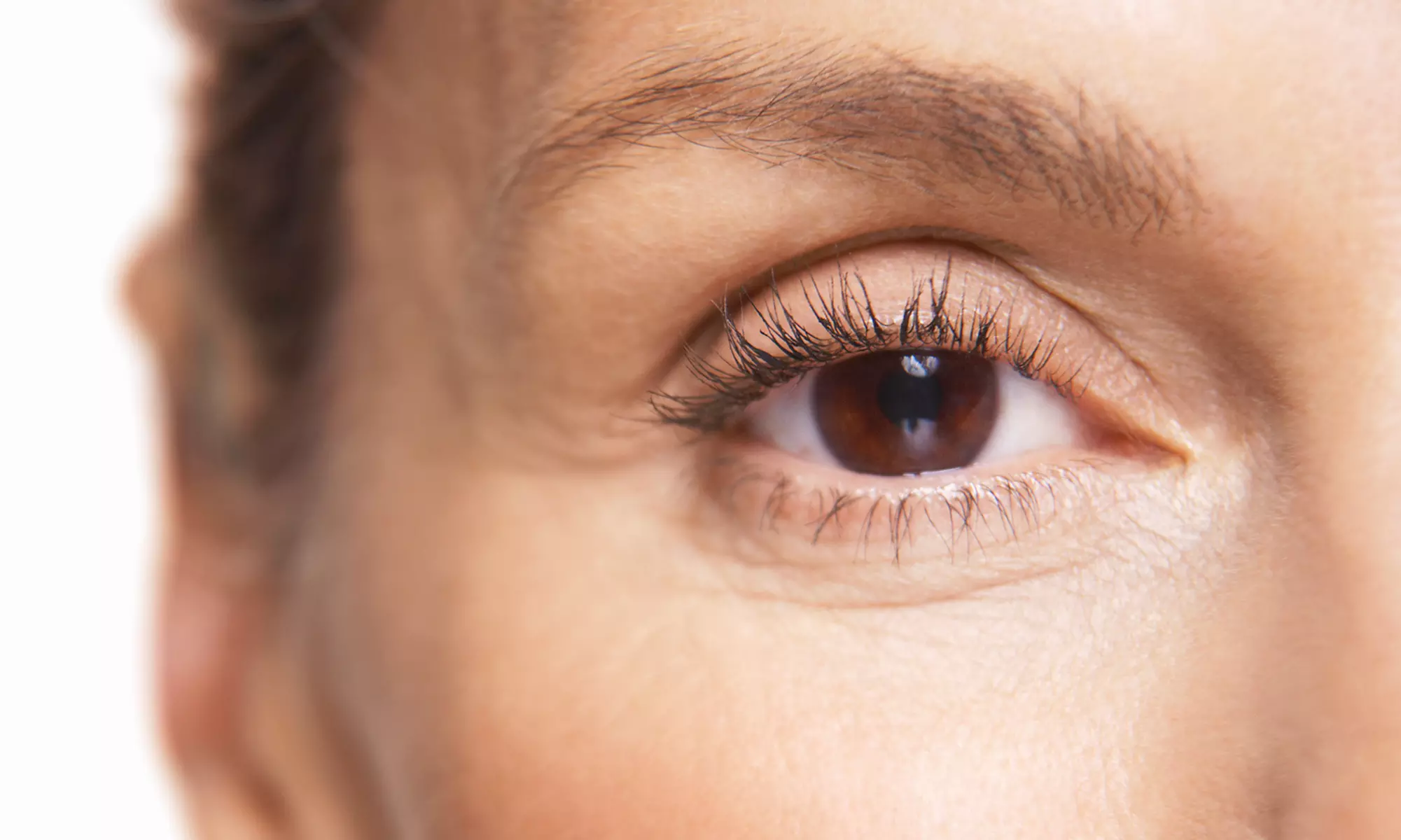 $275 for CO2 DOT Madonna Eyelift Laser Treatment Around Eyes at Transform MedSpa ($800 Value) - Primary Image