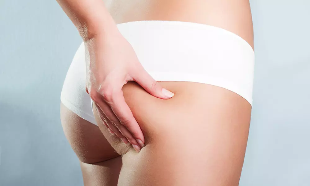 Experience Cryo Body Contour & Sculpting's Brazilian Butt Lift sessions with wood therapy, cryotherapy, and cupping for up to 31% off - Primary Image