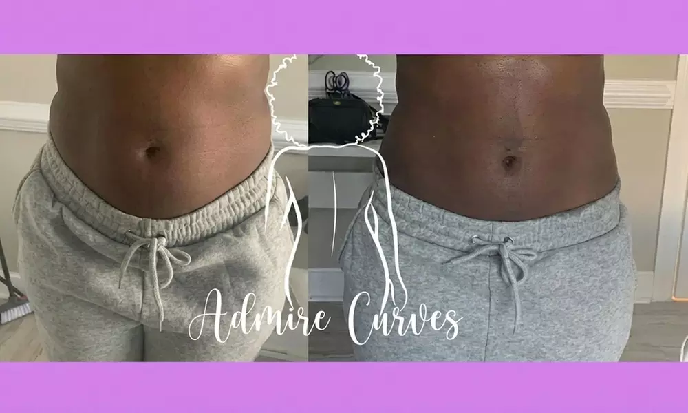 Birthday Body Sculpting Packages for Waist, Tummy & Thigh Body