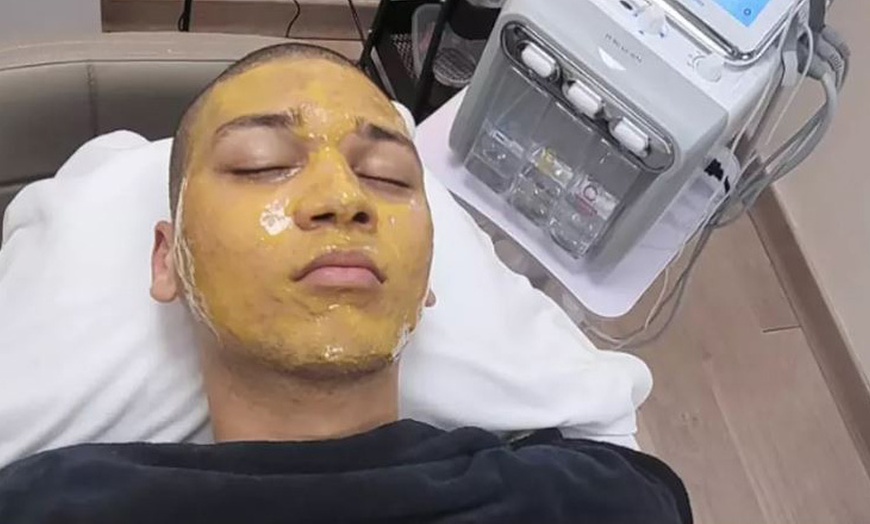 Image 3: Hidrolimpieza facial con radiofrecuencia y electroestimulación 