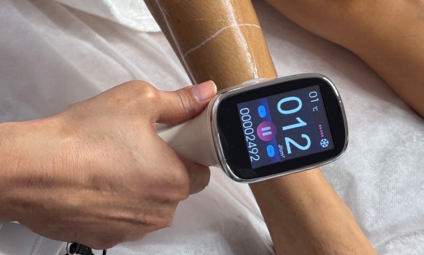 Image 6: Diode Laser Hair Removal: Two or Four Sessions at TEAMO&T Bondi Juntion