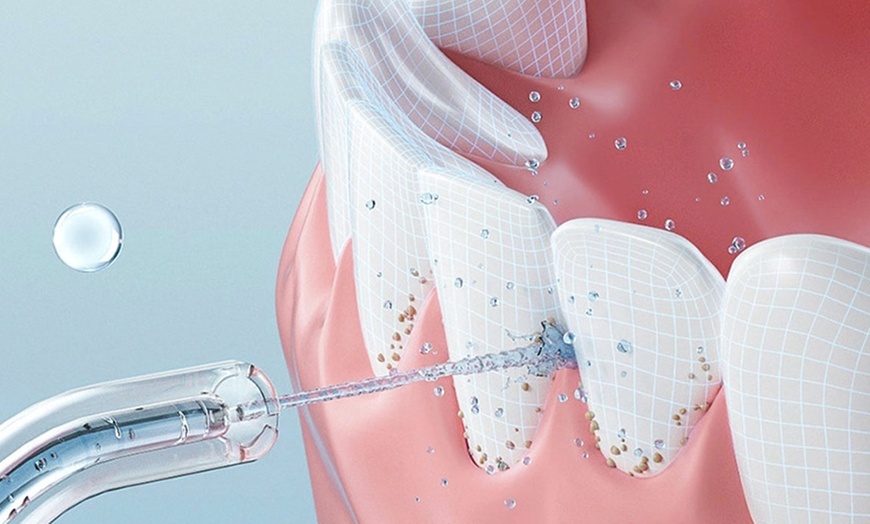 Image 3: Oral Irrigator Water Flosser
