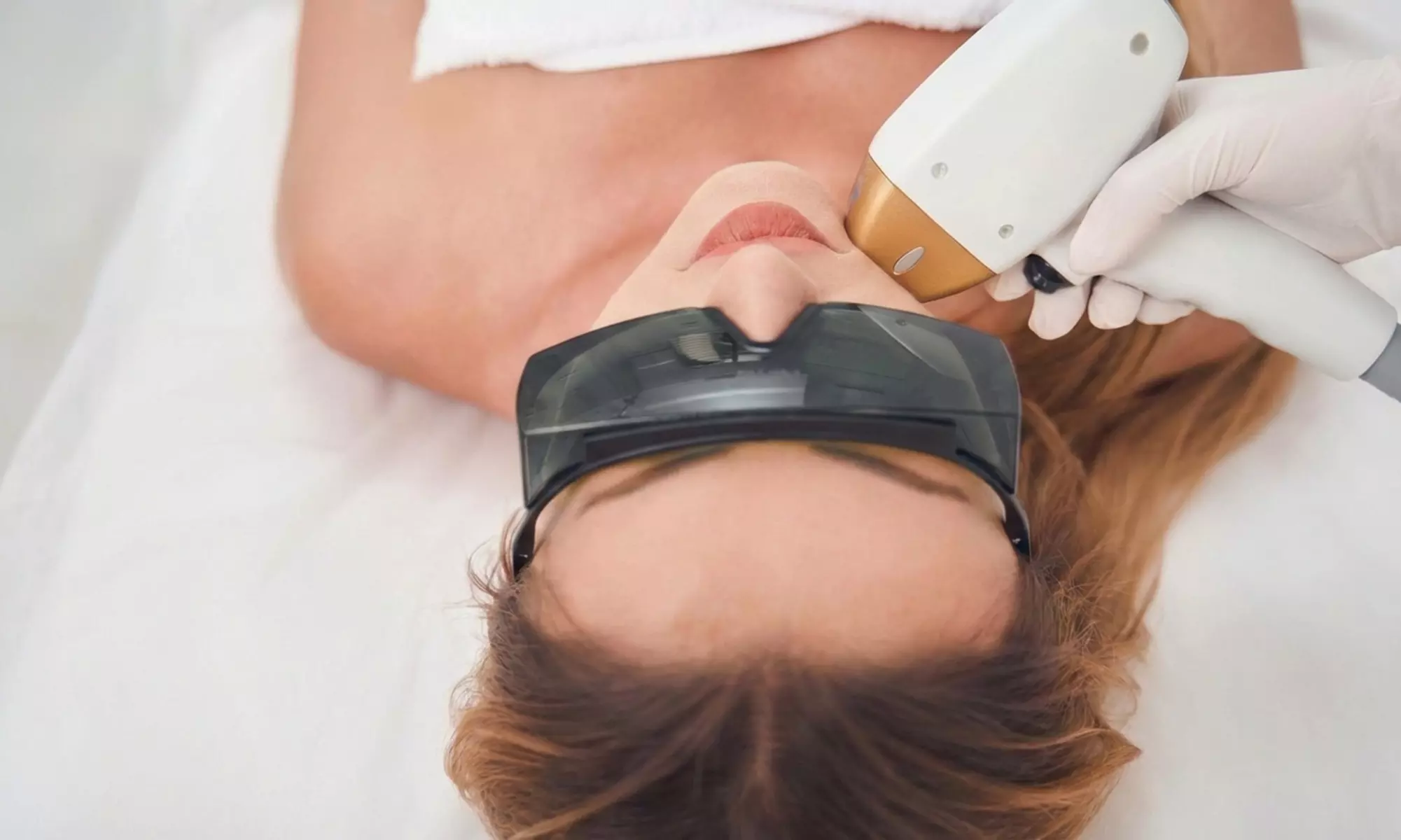 Frax Package of 3 Full Face Laser Skin Resurfacing (Up to 51% Off) - Primary Image