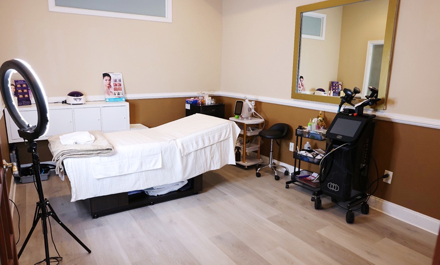 Image 2: Sculptra Treatments in Springfield, PA
