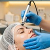 Image 1: Get One or Two  session of Dermapen 4 Full Face Microneedling