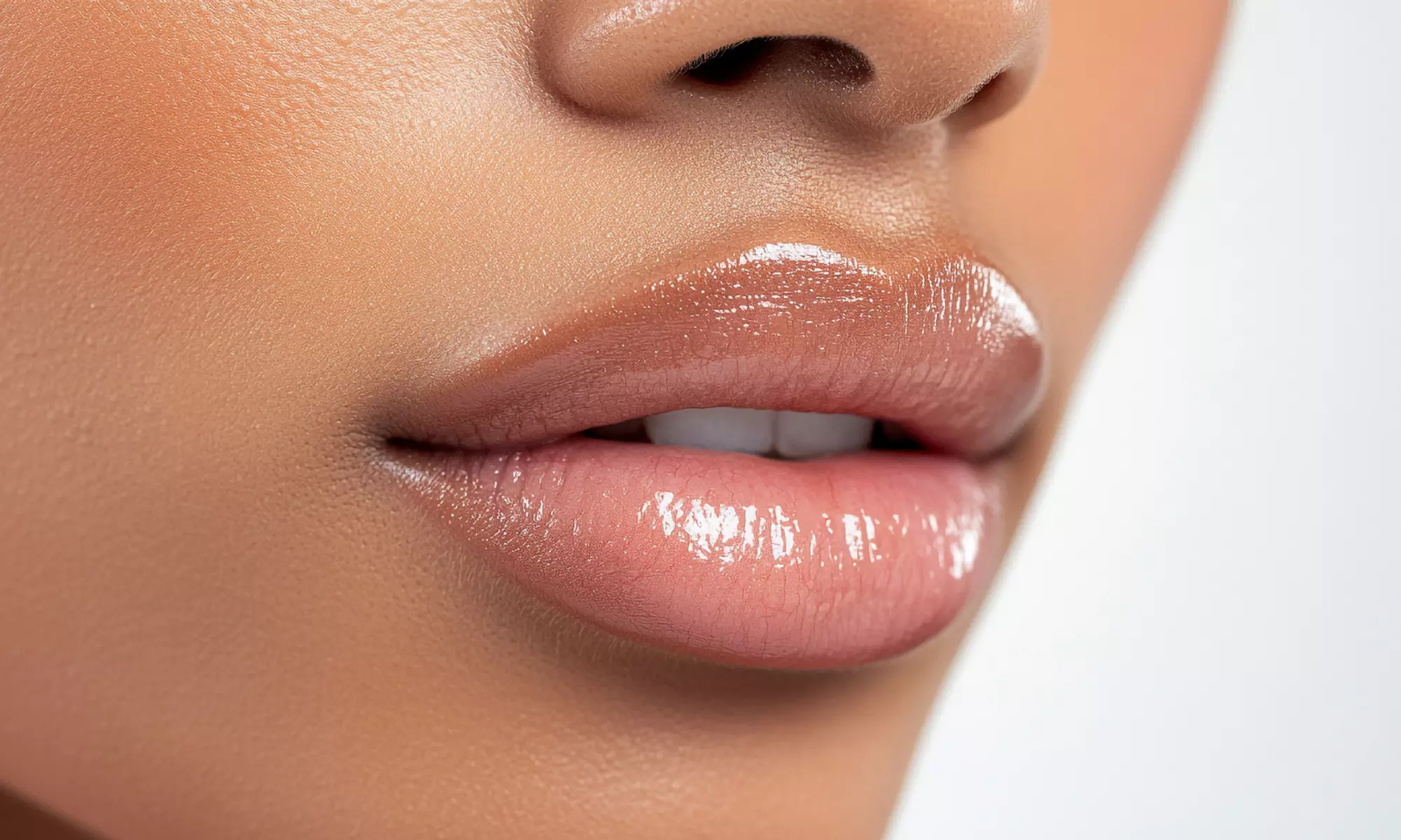 Achieve Youthful Glow with 20, 40 , or 60 Units of Xeomin Treatment (Up to 33% Off) at Rose Medspa