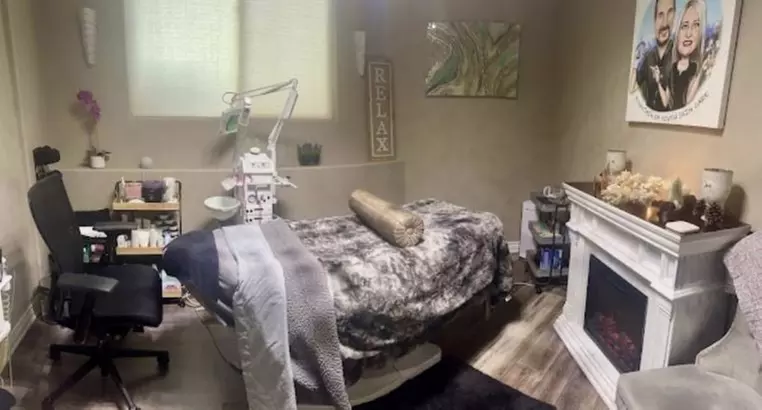 Enhance Your Lips with a Subtle Botox Lip Flip w/w/o Lip Plumper Gloss