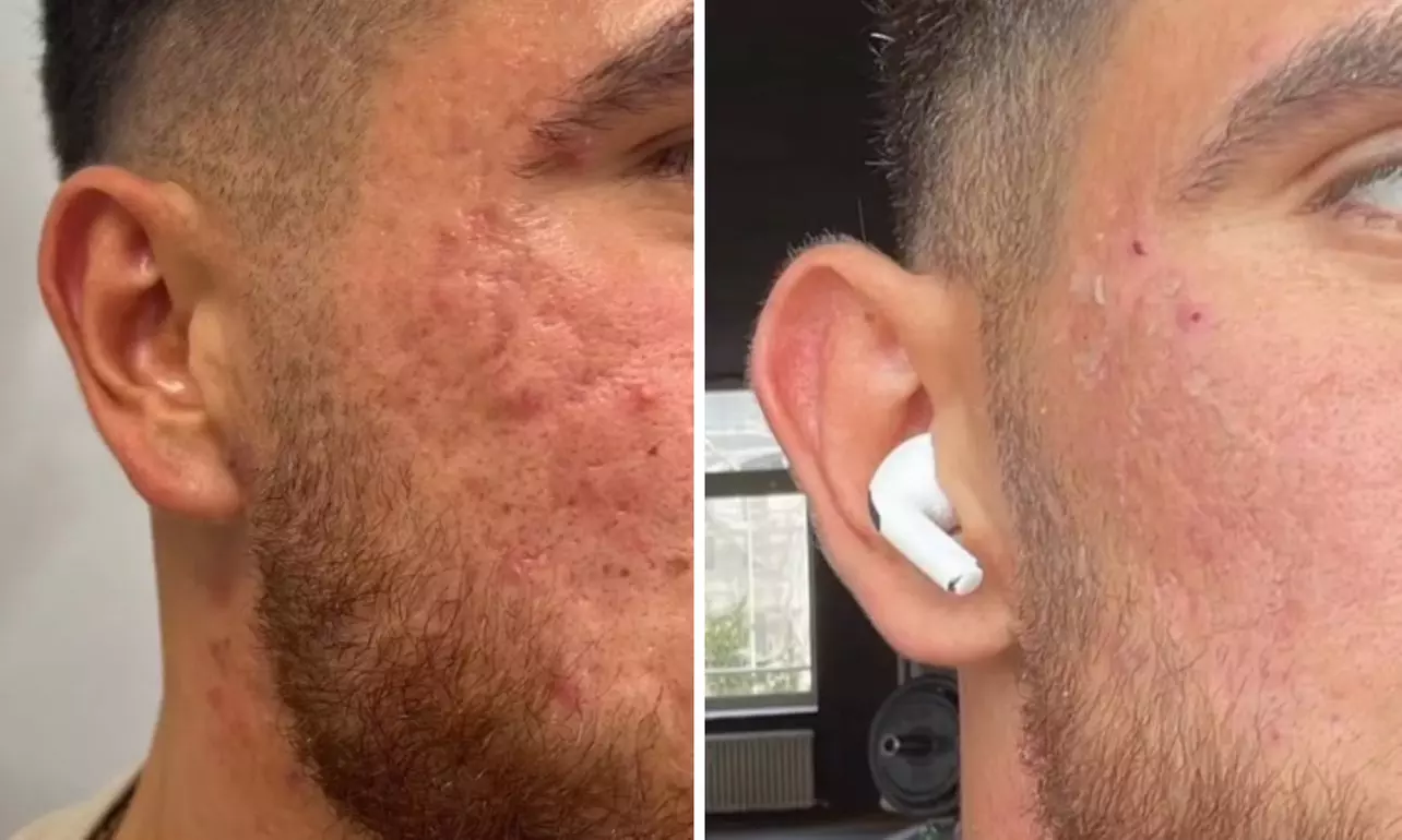 Porentiefe Gesichtsbehandlung oder Algenpeeling für 1 Person