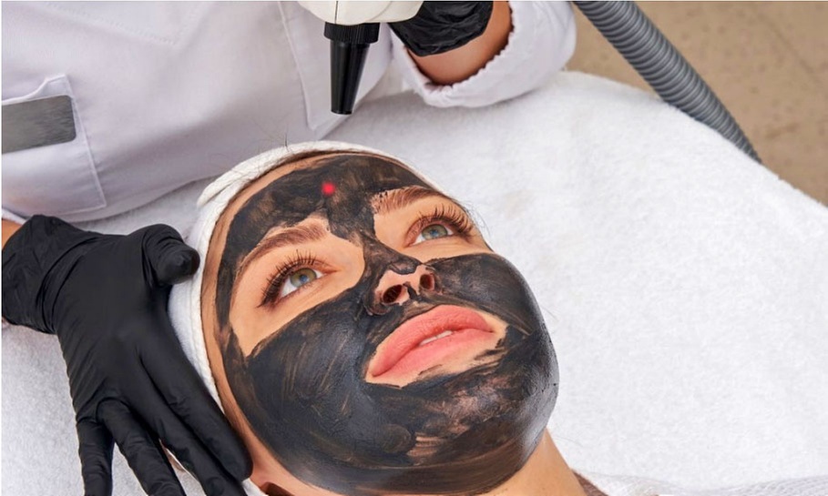 Ervaar een diepe gelaatsverzorging met carbonpeeling: 1 óf 3 sessies