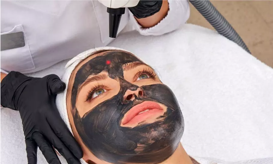 Ervaar een diepe gelaatsverzorging met carbonpeeling: 1 óf 3 sessies