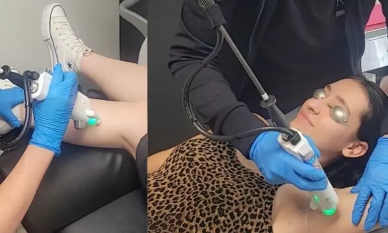 56% Off 5 Laser Hair Removal Sessions at Botox and Beauty Boutiques - Primary Image