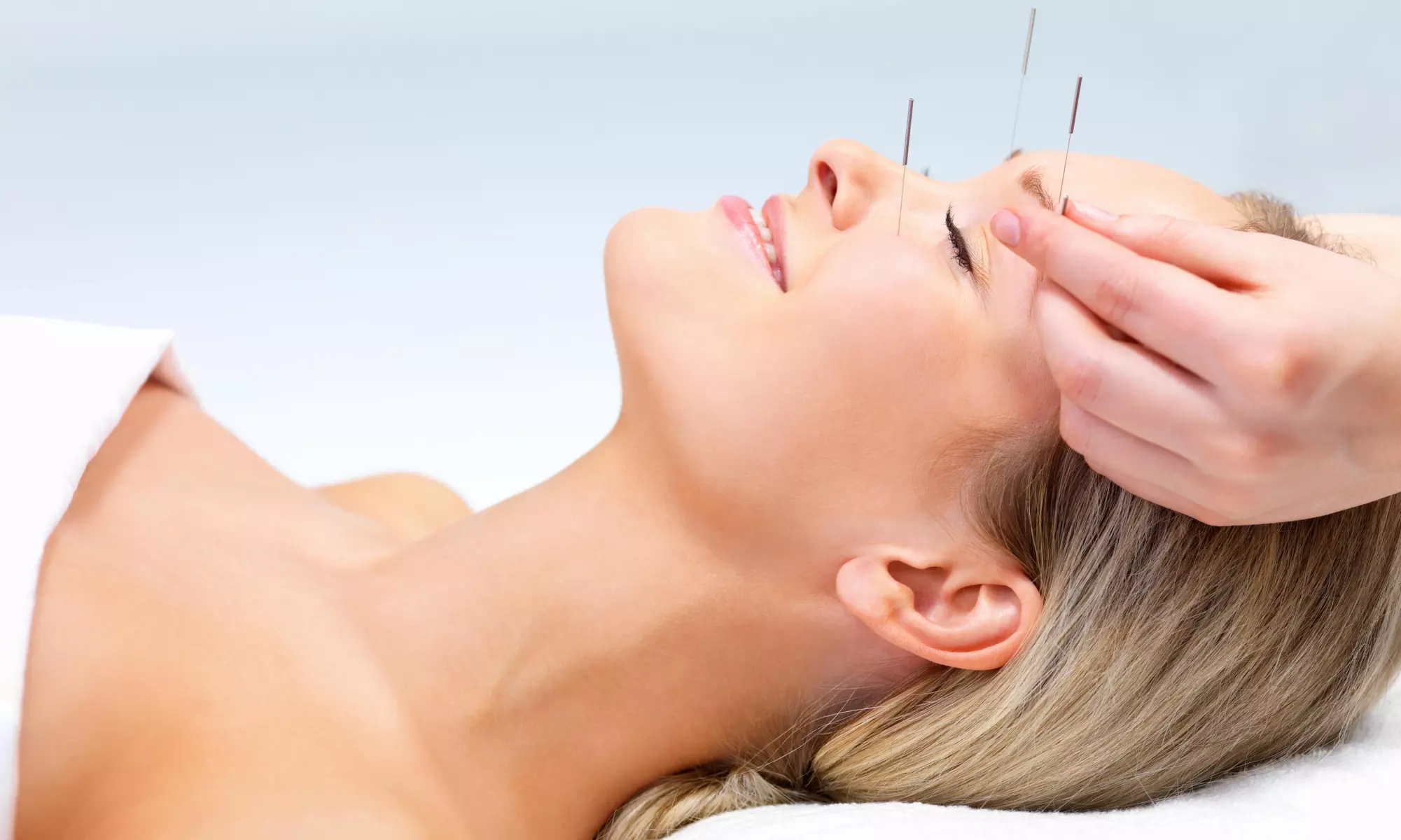An Acupuncture Treatment and an Initial Consultation at Abundant Blessing Acupuncture (65% Off) - Primary Image
