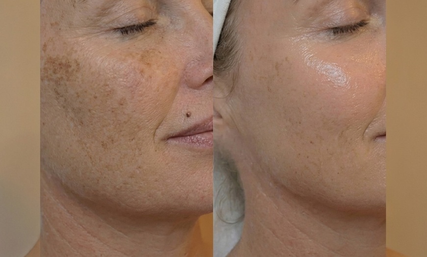 Image 23: Unifiez votre teint avec un soin anti-taches ciblé 5G Removal