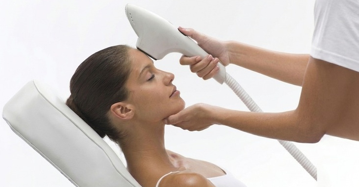 Tratamiento facial de fotorejuvenecimiento IPL en Girona