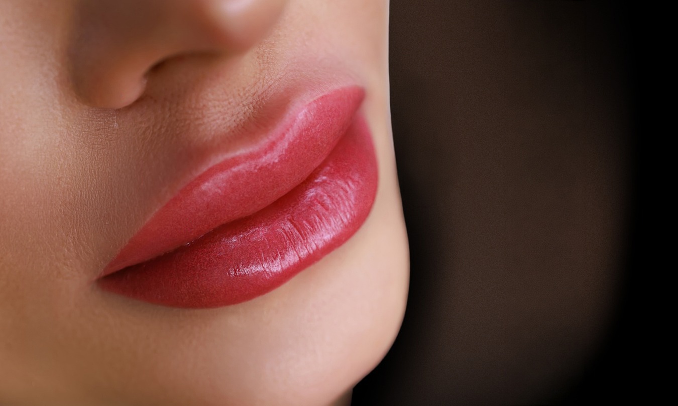 Dermal Filler Treatments:  Russian Lips or Chin to Enhance Volume