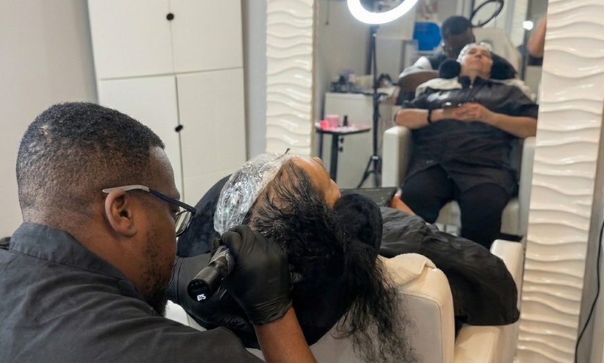 Image 3: Hair Restoration Scalp Micropigmentation : 1 Spot/Partial or Full Head