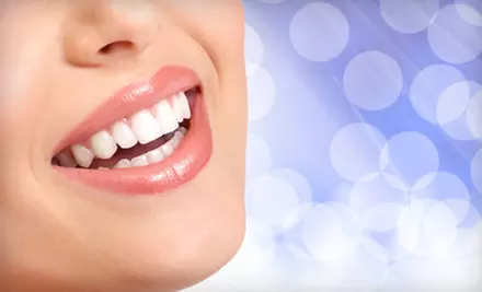 $39 for an In-Home Icing Teeth Whitening from Bling Dental ($199 Value) - Primary Image