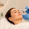 Image 1: Micro-Needling or Dermapen Micro-Needling w/ Hyaluronic Serum with LED