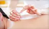 One, Three, or Five Acupuncture Sessions at Apex Chiropractic (Up to 69% Off)