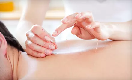 One, Three, or Five Acupuncture Sessions at Apex Chiropractic (Up to 69% Off) - Primary Image