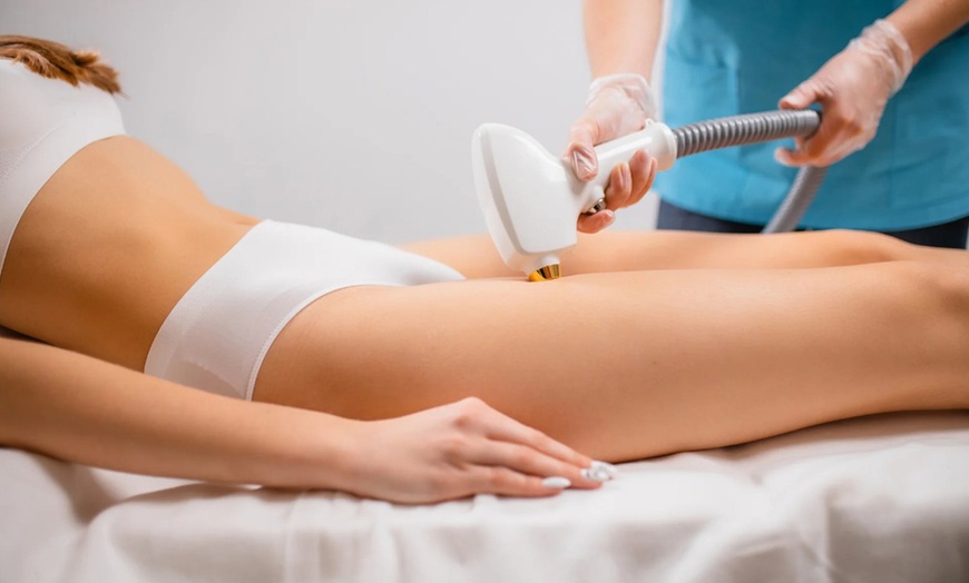 Image 1: Épilation laser haut de gamme chez Golden Skin