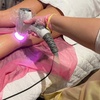 Image 1: Six Laser Hair Removal for Small, Medium, Large or Extra Large Areas