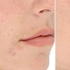 Image 4: LightStim Red Light Therapy Packages | Full Body Treatment
