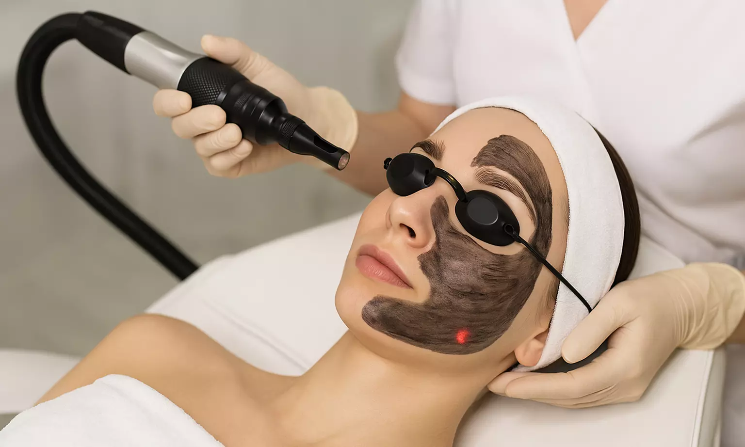 Get Quick Glow-up with One, Two, or Three Sessions of Carbon Laser Peel (Up to 71% Off) - Primary Image