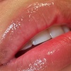 Image 2: Sesión de rehidratación de labios con dermapen y vitaminas para 1 