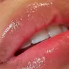 Image 2: Sesión de rehidratación de labios con dermapen y vitaminas para 1 