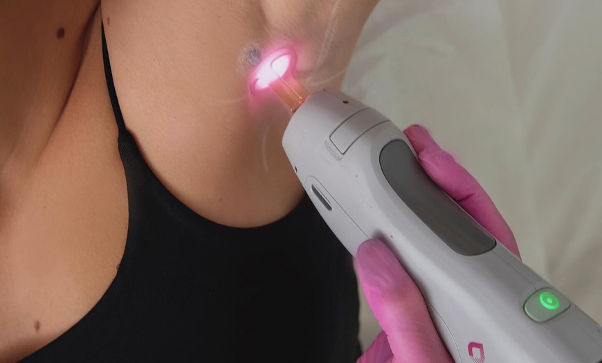 Image 3: Smooth, Lasting Results with GentleMax Pro Laser Hair Removal