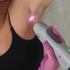 Image 3: Candela GentleMax Pro Laser Hair Removal Treatments at New You Laser