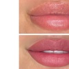 Image 2: Lip Blush Treatment – With or Without Top-Up Options