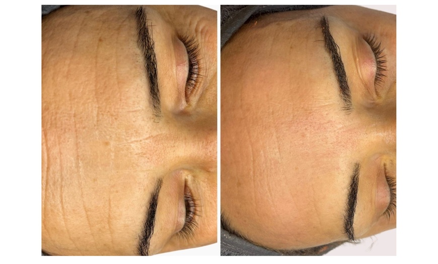 Image 3: Hydra Glow Hollywood Skin Care - Deluxe or Classic, or Mini Facial