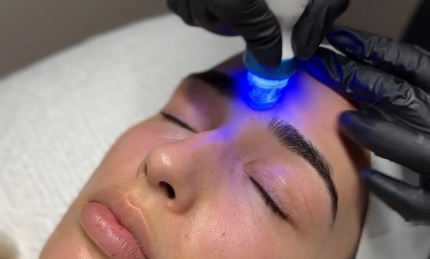 Image 2: Treat Yourself to a Flawless Glow with Our Facial Packages