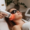 Image 2: Fotorejuvenecimiento facial y eliminación de manchas con laser IPL