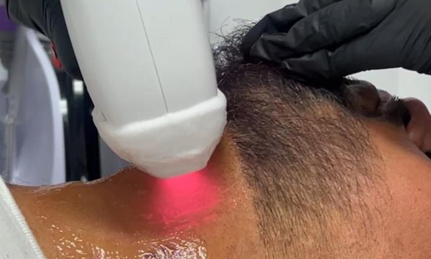 Image 8: Six Laser Hair-Removal Treatments for Every Area Size