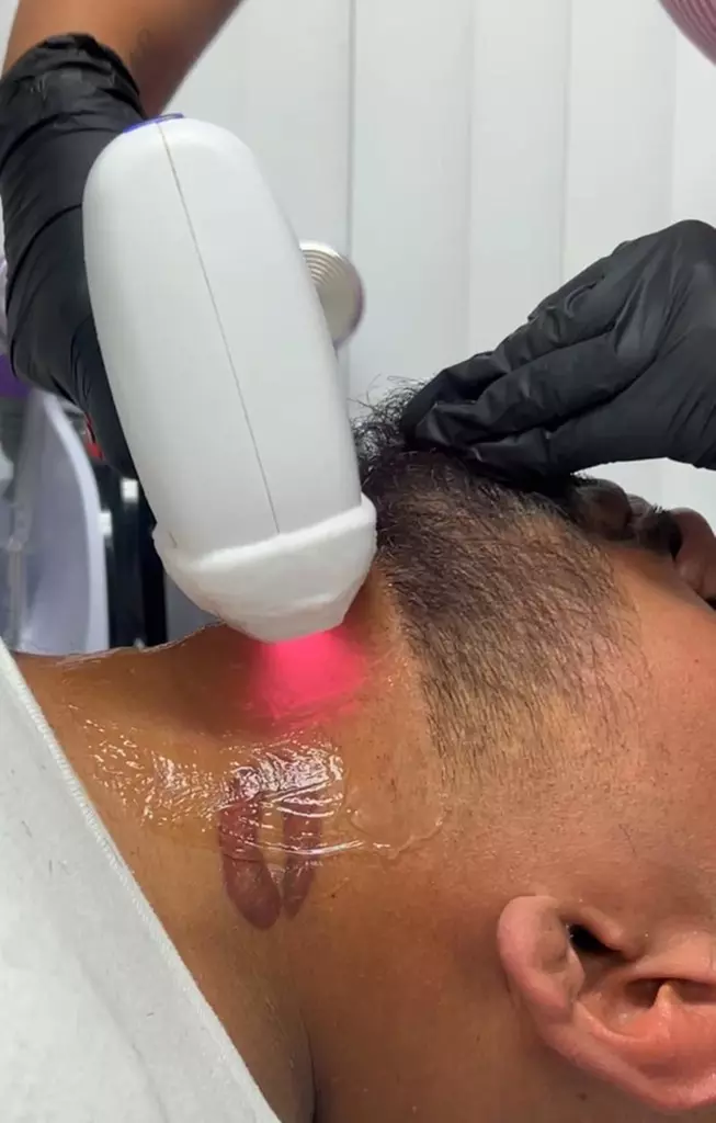 Six Laser Hair-Removal Treatments for Every Area Size