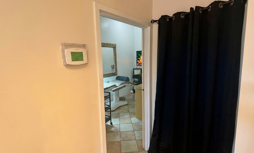 Image 10: One, Three or Five Microdermabrasion Facial Sessions for Smoother Skin