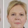 Image 2: Glowing Skin with One or Two Seventy Hyal Treatment & Consultation 