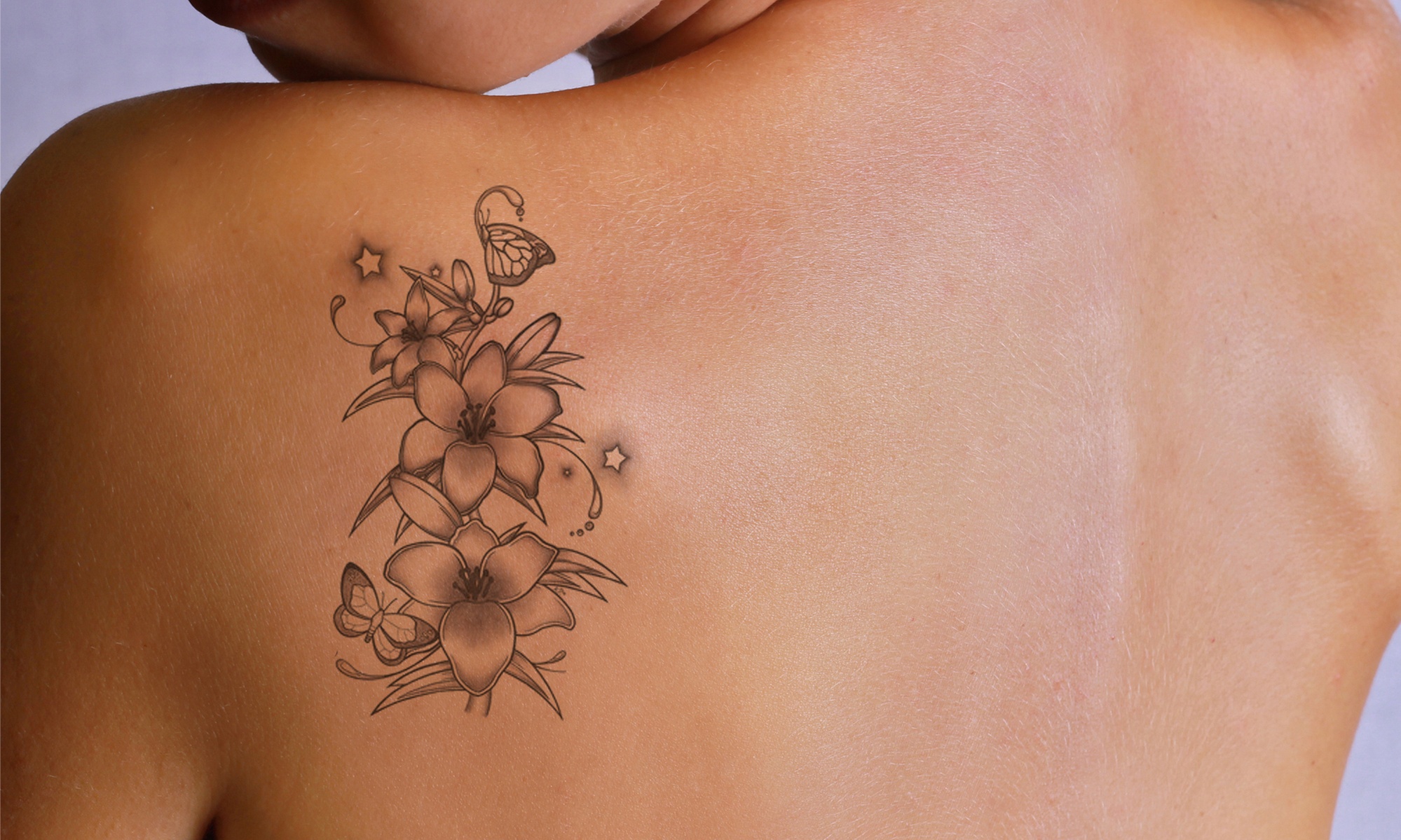 Erase Tattoos Gently with Laser Techniques for All Sizes