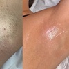 Image 2: Three or Six Laser Hair Removal Sessions for S, M, L Areas / Full Body